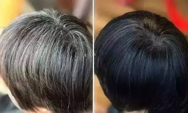 只黑头发不黑皮肤洗后是清水只需抹一抹白发立马变黑发赶紧告诉家人吧