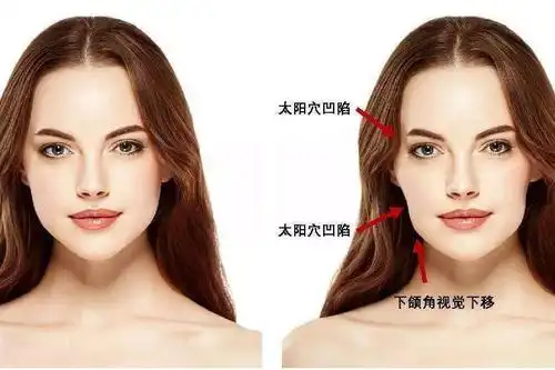 有一些国际超模脸型就和大家所描述的【牙套脸】很一致,那些【超模脸