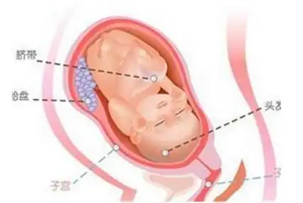 胎儿入盆后多久生:什么是胎儿入盆 胎儿入盆是什么感觉