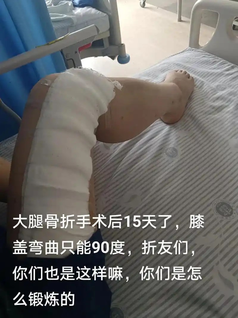 你们也是这样嘛你们是怎盖弯曲只能90度折友们大腿骨折手术后15天了膝