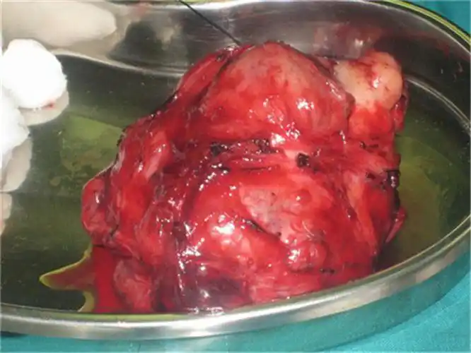 肿瘤专家_治疗肿瘤哪个专家好_治疗肿瘤最好的专家/排行_有来医生