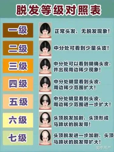 在毛囊受到影响的初期,刚开始出现大量的掉发现象,头发还没有明显稀疏