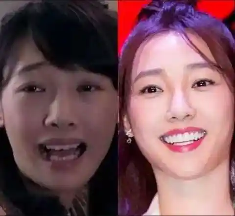 吴宣仪的牙还有救吗