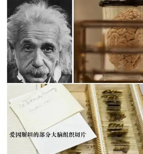 爱因斯坦的大脑切片