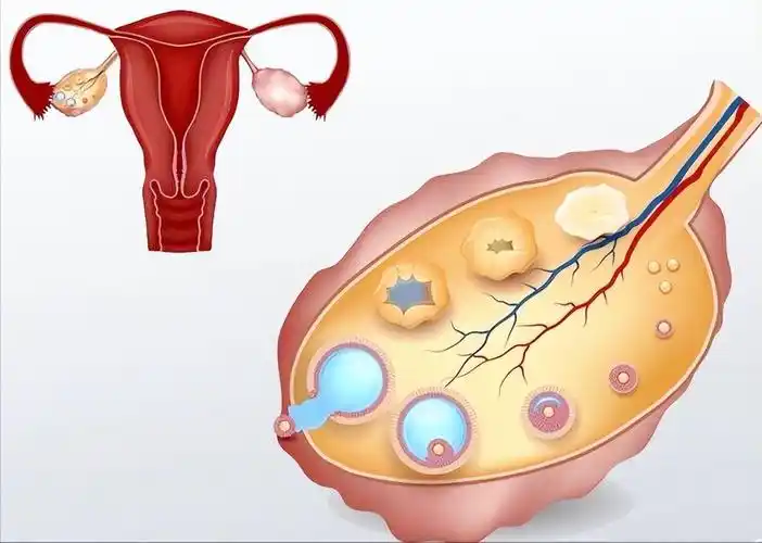关于女性生育力,你不得不知的促*泡生成素fsh