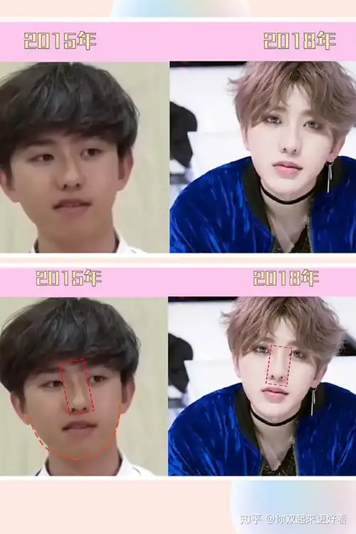 这张脸太假了蔡徐坤为什么总是被说整容