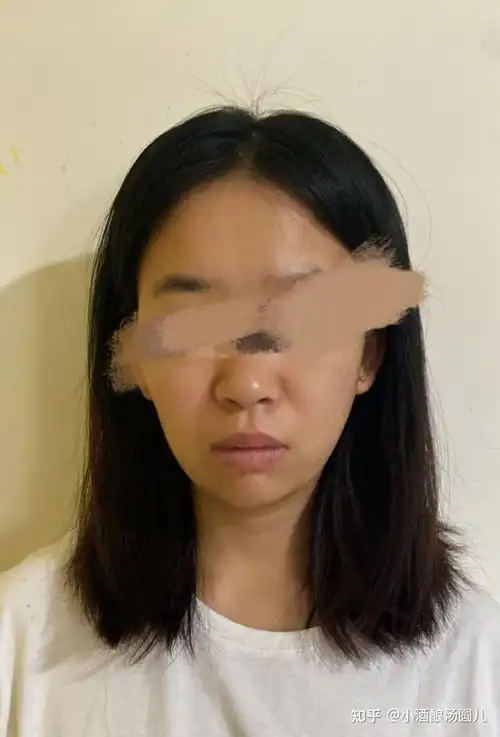 我22岁,有一颗虎牙,想牙齿矫正,医生说拔虎牙后边的一颗牙就可以了