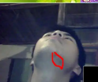 右边下颚里面疼