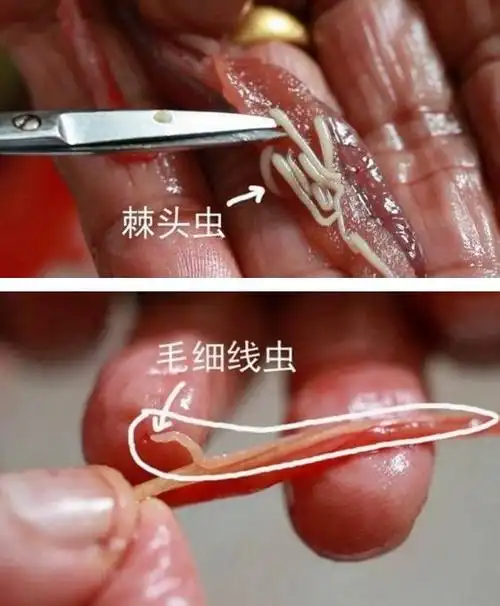 6种食物超多寄生虫常吃伤腑脏还有人不懂