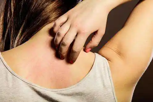 冬季皮肤瘙痒难耐用它洗浴有奇效