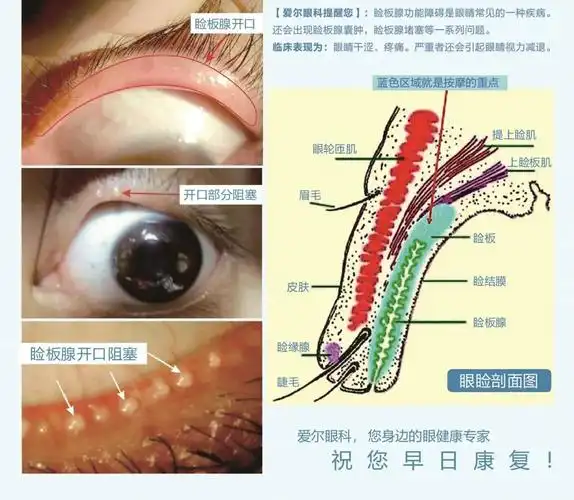 淄博康明爱尔眼科医院眼部按摩的秘密