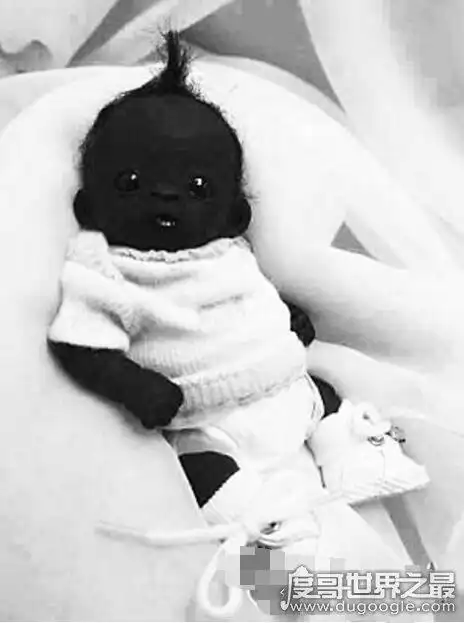 南非世界上最黑的孩子,证据证明90%是作假(黑的不合常理)