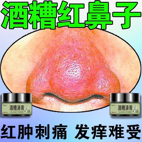 粗大收缩毛孔去黑头草莓鼻红鼻子玫瑰痤疮去粉刺草本软膏舰旗官方店