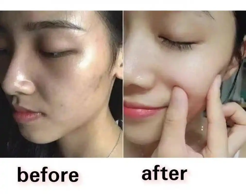 成为氧气美女的必杀技_皮肤