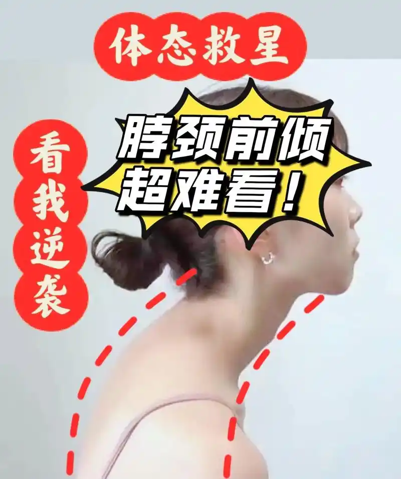 姐妹们 这简直是脖子前倾和"低头族的福利.巨好用的东西,用了 - 抖音