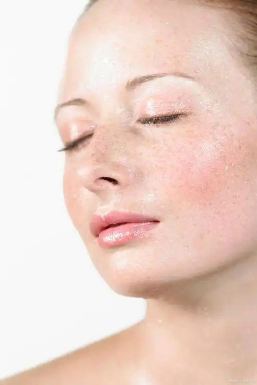 揭秘激光去红血丝:反弹真相解析!中招原因揭秘,你是否中招了?