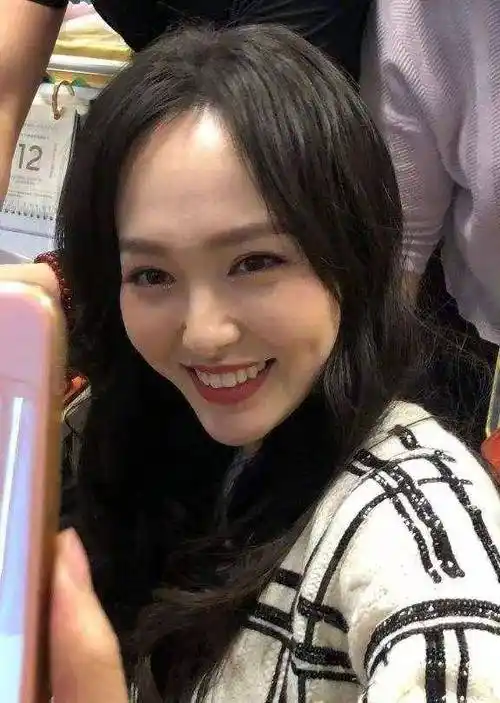 7位女星的额头杨紫被说像寿星公杨幂发际线后移拉长脑门