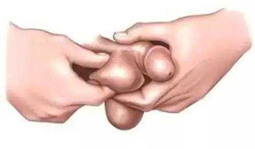 医生医生还指出,由于这睾丸炎的病种不一,男人朋友的疼痛性质有胀痛