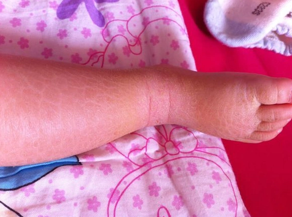 诺恩贝迩louennber教你如何给宝宝全方面护肤护理