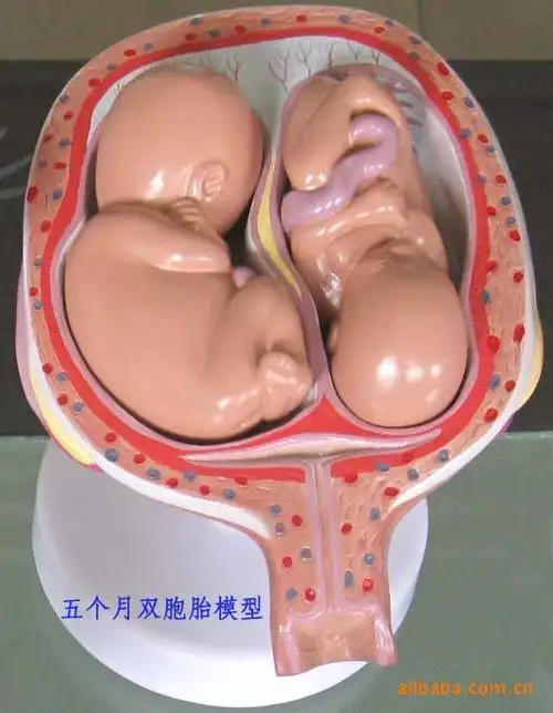 注:成型的胎儿都可以从子宫中取出哦!