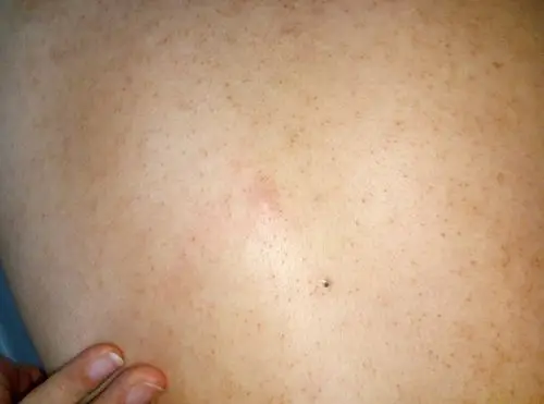 后背起了一个黑色小包