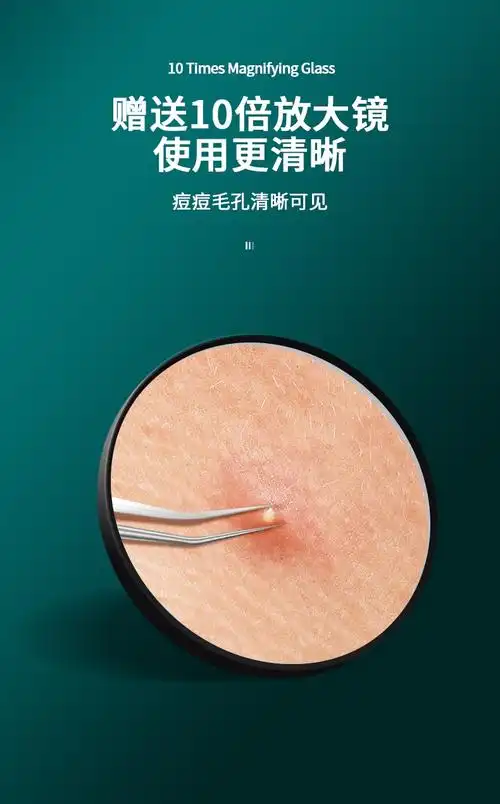 超细尖5号细胞夹去黑头镊子美容院粉刺针挤痘刮闭口专用工具5号超尖