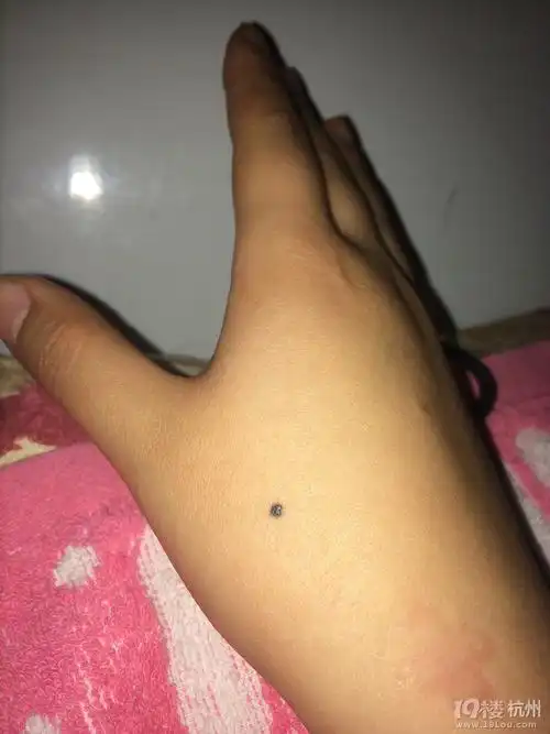 右手虎口处有颗痣有什么寓意吗
