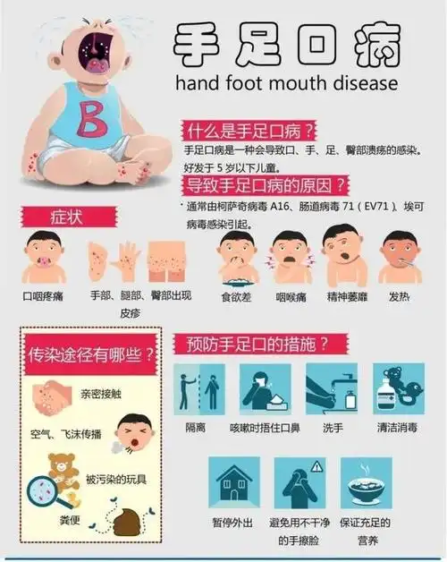 手足口病是由多种人肠道病毒引起的一种儿童常见传染病,多发生于5岁及