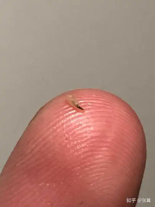 黑头大到直接挤出来是什么感受?