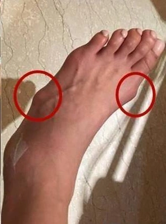 女星的脚比普通人的脚更可怕:颖宝最心疼,她最苦命!