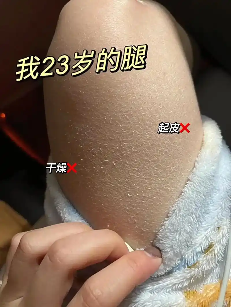 皮肤干燥又粗糙!显得老!还在为冬季皮肤状态差烦 - 抖音