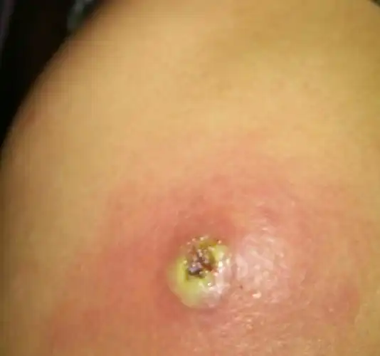 问一下这后背长的什么