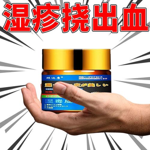 【日本技术】严重湿疹慢性皮肤瘙痒红肿神经性皮炎丘疹杀菌止痒膏