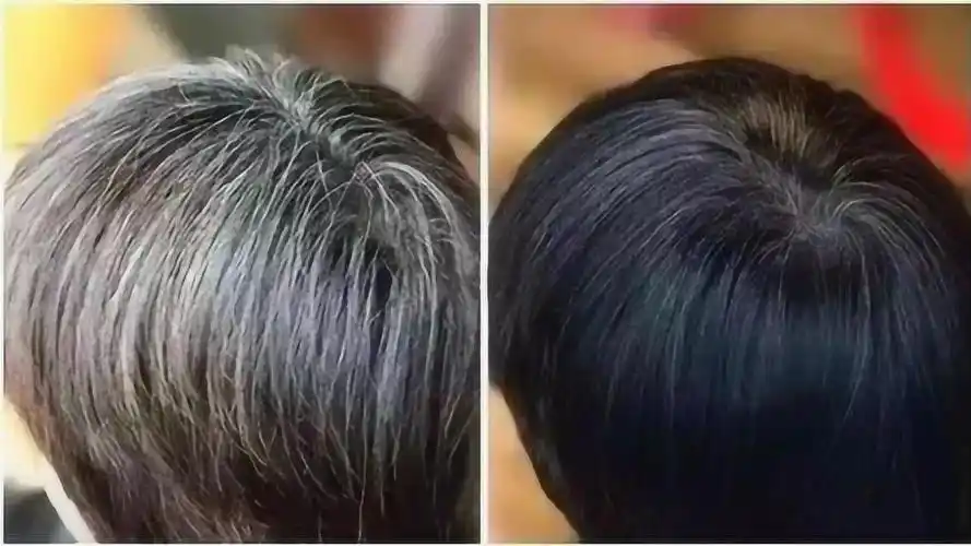 白头发太多很难看教你不花一分钱轻松变黑太厉害了