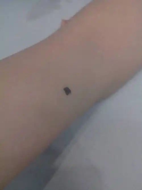 手臂弯处内侧有痣(手臂弯处内侧有痣代表什么)