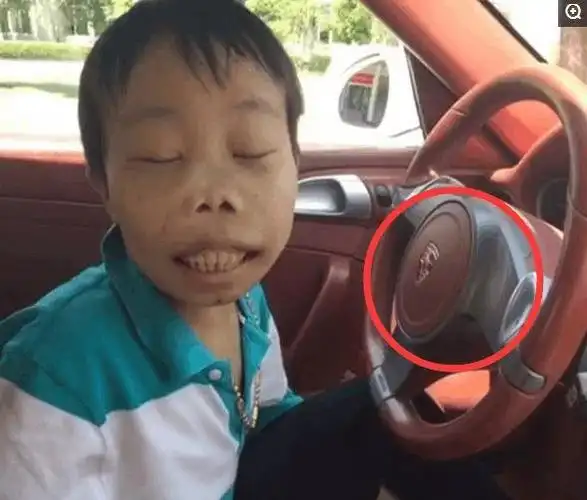 土豪长得像外星人, 奇丑无比, 出行兰博基尼旁边美女成群