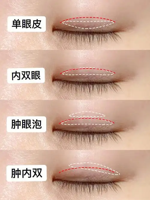 干货604种实用双眼皮贴教程单眼皮变双眼皮