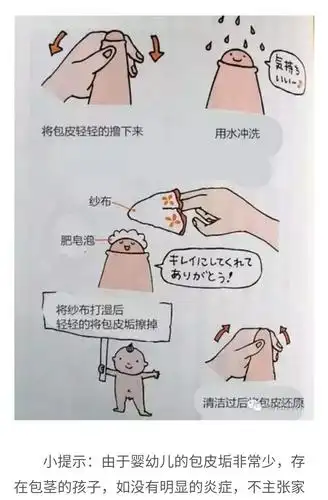 孩子割包皮这件事,你进误区了吗?家长必看 - 好大夫在线