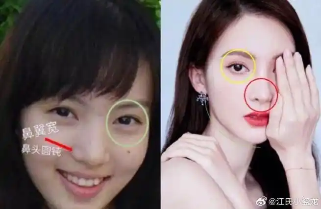 看看今晨整容前后的照片,主要就是鼻子,眼睛和下巴,特别是鼻子,丈成