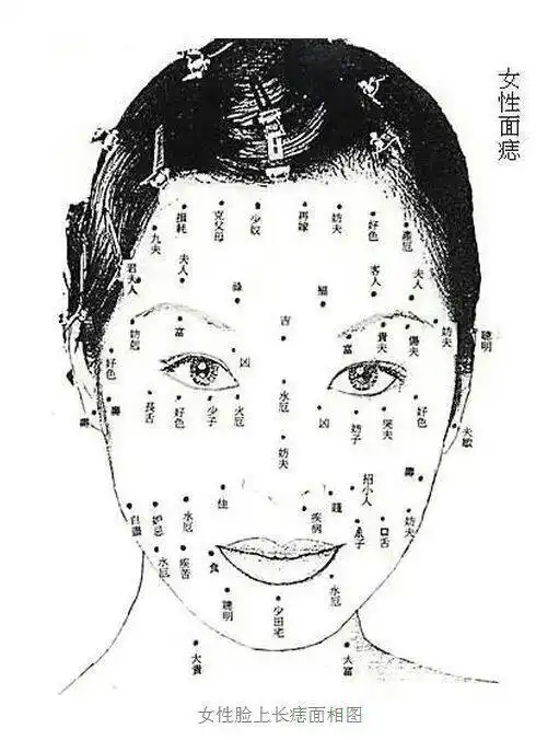 脚上长痣代表什么脚趾上长痣有什么含义没