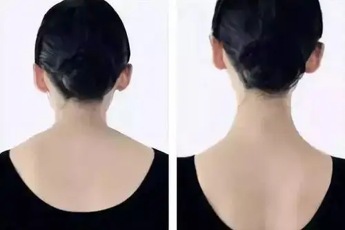 现代人习惯的很多不良姿势,都会导致斜方肌紧张,甚至对腰腹,脊椎的