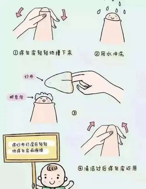 年年岁岁花相似孩子包皮到底割不割