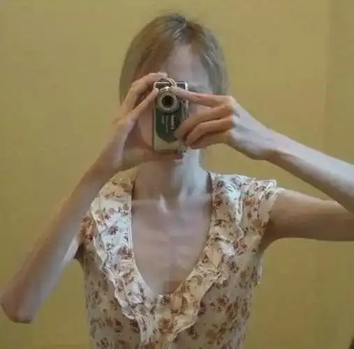 要么瘦,要么死?减肥辛酸史集结!