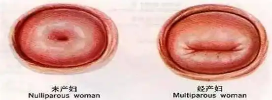 生过孩子和没生过孩子的女人有什么不同