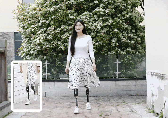 再就是假肢是越轻越好,所以重点来了,截肢患者选择大腿假肢最低标准