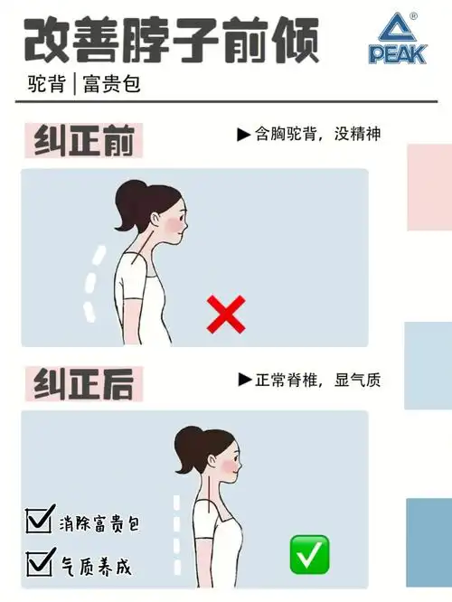 气质养成6招快速解决脖子前倾